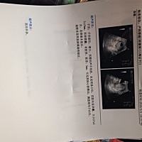 好奇的想知道是男宝女宝。