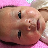 宝宝脸上这么多这个，宝妈们知道擦什么会好？