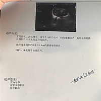 47天没有看到胎芽，很沮丧😦大家给看看怎么办呀