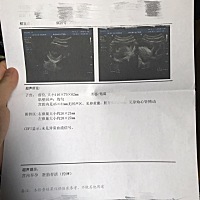 大家帮忙看看男宝还是女宝，二胎，希望成好字。