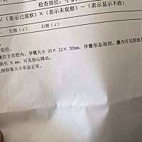 今天满8周二次检查，一切正常，6周时候检查啥也看不到，大家还是不要太早