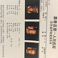 谁能看出是男宝还是女宝