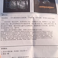 帮忙看男女谢谢～～有么有孕妈和我一样的整天想吃凉的～西红柿哇黄瓜哇凉皮哇……都说喝纯奶的孩子白可...