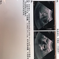 亲们，帮忙看看这个正常吗？有没有问题，在给参考一下谢了。