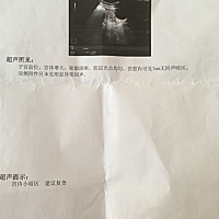 是不是太早去检查了 3.4号 自己在家 用检测棒 发现怀孕的 之前 检查都没有 3月11去检查 送查不到胚胎 验...