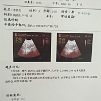 七周 无胎芽胎心 担心中 今天检查了孕酮和叶酸值 结果还没出来 真怕 会不会是个空孕囊啊 有经验的宝妈帮...