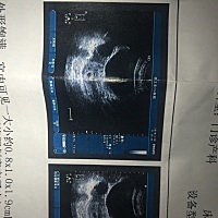 谁能看出这个孕囊大小是男孩女孩