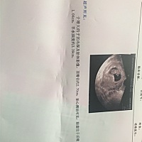 谁会看，帮我看一下男孩女孩呗