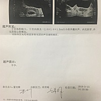 今天早上起来有点出血，去医院做检查结果没事，让在家休息，说有点先兆流产，分泌物有一点血丝，没事吧...