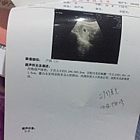 帮忙看看男宝女宝啊