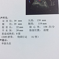 看看是女宝还是男宝