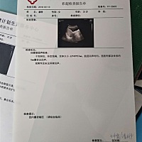 怀孕43天  早上做的检查是这样的   刚才上厕所有褐色分泌物  我想知道是怎么回事