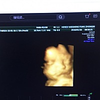 32周了想凑好字，能如愿吗