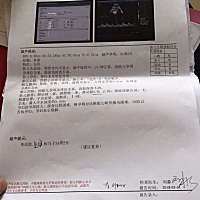 前两天做的B超，双肾有分离耶，说分离是男孩，真的么？^_^