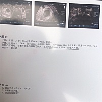 孩子是不是太大了 为什么会大那么多