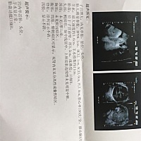 是男宝宝还是女宝宝啊？各位亲🙆。 刚检查b超是个男的真的好尴尬啊！老是使劲叫我拉低裤子☹️