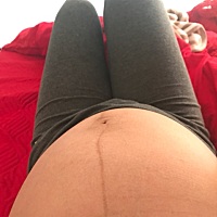 37周加5天 宝宝头还在上面怎么办，医生建议我选个日子去刨腹产，可是我不想刨腹产，有没有其他办法让宝...