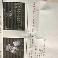 有会看的帮我看看男宝，还是女宝？