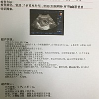 今天单位体检，怀孕44天，有胎心胎芽，早孕反应八天了，恶心