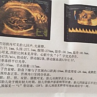 记录32周➕产检状况 希望宝宝健康平安出生🐣