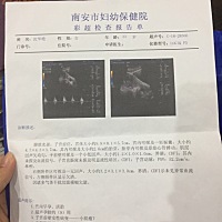 有会看男孩女孩的吗？