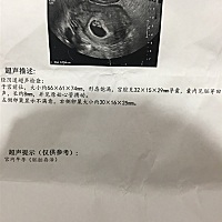 懂的宝妈帮忙看看是男孩女孩呀