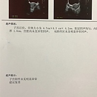 验血结果显示怀孕，接着7周了去做超声检查竟然没有发现孕囊，其他方面都很正常符合怀孕的特点，但是就是...