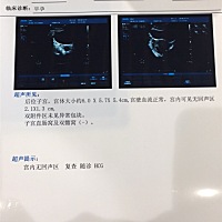 今天去医院检查大夫说孕酮低没有胎心，回家吃一星期药在复查，不行就不能留了，末次月经1月15日，求助一...