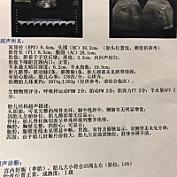 这个是32周时候检查的，大神们，麻烦帮我看看男孩女孩，属于好奇，下个月就生啦。看看大神们说的对不对。