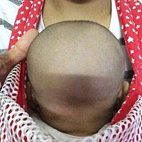 宝宝刚一百来天睡偏头了，脖子也跟着偏左边，有什么解救的办法，是让他睡偏得那边吗，他会不会变歪脖子...