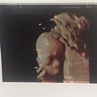 接好孕，马上要和我们的小天使见面啦，期待你的到来，爱你，宝宝👧🏻👧🏻👦🏻👦🏻💕💕