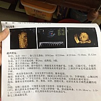 男宝？女宝？有会看的吗