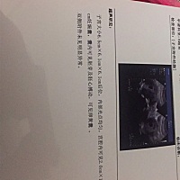 姐妹们能看出男孩女孩吗？