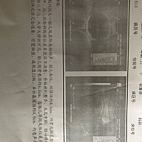 有没有会看男女的。第一胎37周 3非常好奇