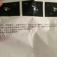 没出血没腹疼，可是今天去检查，说有积血，要保胎！😭 有事吗？刚好8周 请问有没有姐妹知道后面那两个...