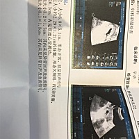 老人都说40-50天的b超就可以看出是男女了，大家有没有会看的帮我看下是女宝还是男宝