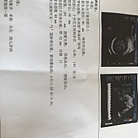 昨晚因为一些事情激动哭了好久，老公不放心快12点了都陪着去医院检查的，医生说没有多大的问题！很好奇...