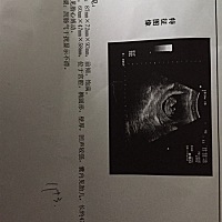 听说B超能看出是男是女，这个怎么看啊！能看出性别吗？求解