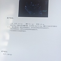 9 6总算还是一个人去检查了^o^第一次检查心里没底，一直拖着没赶去！