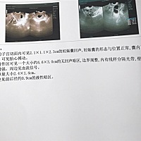 听说孕囊数据可以知道是男是女？第一胎，男女都一样,但是有点好奇，有没有会看的呀哈哈