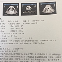 有没有会看男女滴呀，快生了，还是想知道