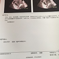 7周2天啦，有会看男宝还是女宝的吗！
