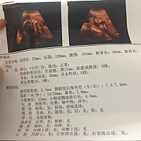 有能看懂的吗，男宝还是女宝
