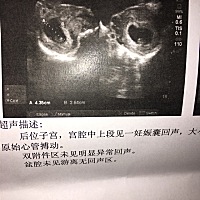 不会又是男孩吧？