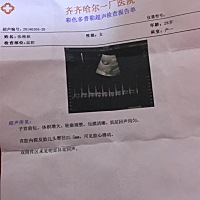 9周时候做的b超，能看出来男宝，女宝吗