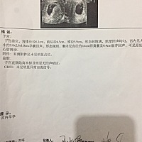 这样能看出是男是女吗