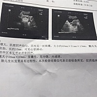 二胎孕8周的B超单，大家帮忙看看，男孩还是女孩