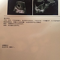 不知道是不是怀孕的时间短，显示未见胚芽回声，医生让过两周去复查，好担心