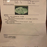 看囊可以看男女，大家帮我看看男孩女孩？💋