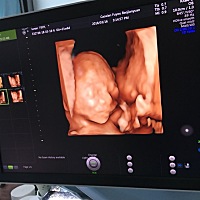 姐妹们，猜猜是男孩，女孩，